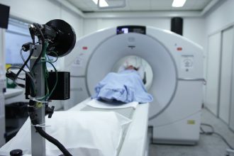 dexa scan