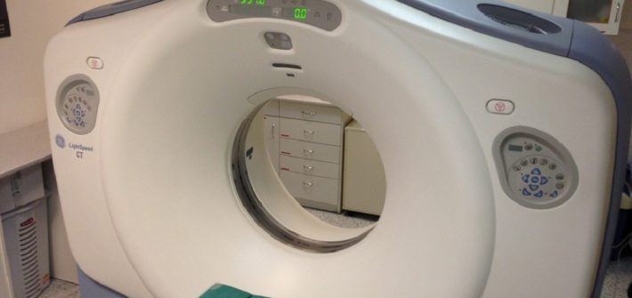 CT scan