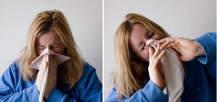 Allergies