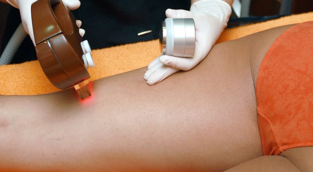 hair-removal-4188610_1280