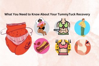 Tummy Tuck Recovery