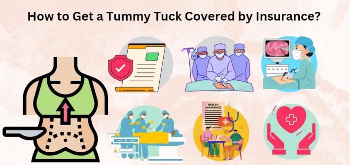 tummy tuck